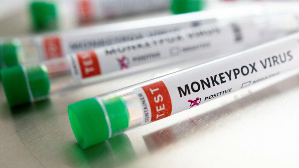 Monkeypox