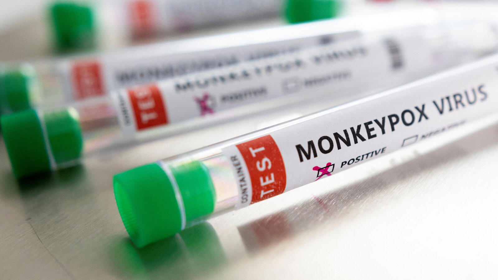 Monkeypox suspected cases rise to 141 in 13 States in Nigeria