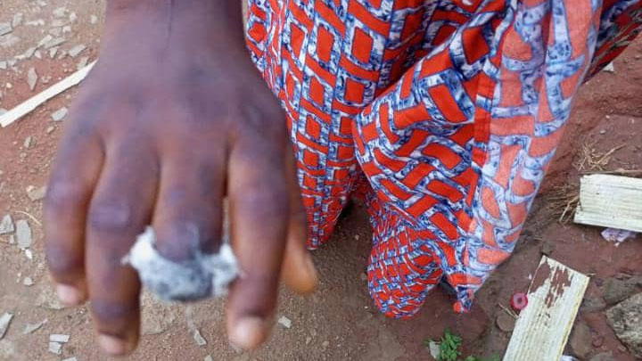 Retired Customs officer chops off 10-year-old girl's finger over missing N50 that was later found