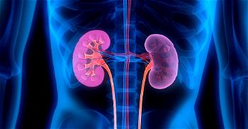 Lifestyle Choices: Over 20 million Nigerians living with kidney challenges — Dr. Eso
