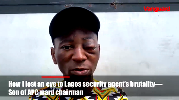 VIDEO: How I lost an eye to Lagos security agent’s brutality -Son of APC ward chairman