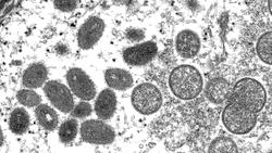 More than 6,000 monkeypox cases reported globally as WHO calls for emergency meeting