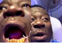 Funny moment Nollywood actor, Mr Ibu visited a dentist [Video]