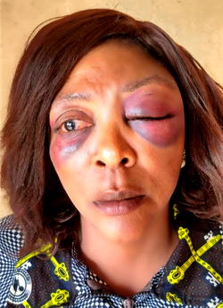 NSCDC personnel brutalises woman over parking space at Jos betting spot