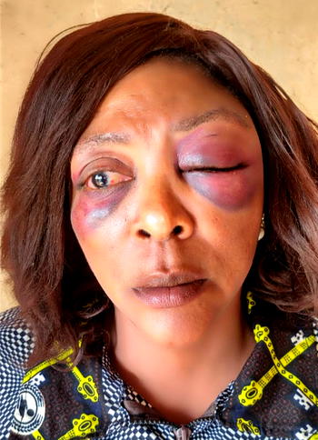 NSCDC apologizes to assault victim, promises to punish personnel