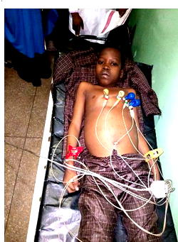 Zaid, 14 needs N3.3m for urgent heart surgery