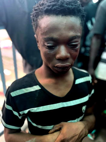 Man using kids with fake stomach tumour to beg, nabbed in Lagos