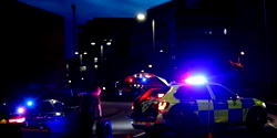 83-yr-old British widow in critical condition after dog attack