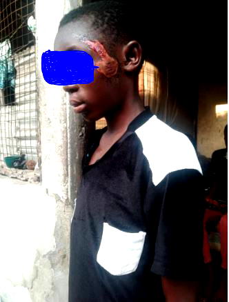 Biker’s incident: Survivors recount ordeal, as death toll rises to 8