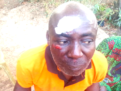 Photos: APGA kicks as hoodlums attack its Coordinator, supporters in Ebonyi