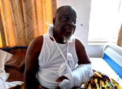Insecurity in Abia North: Ex-lawmaker shot, recounts encounter with bandits