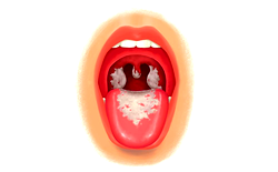 What to know about Diphtheria and how to stay safe