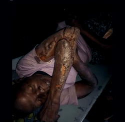 Activists, lawyers, others to get justice for man accused, set ablaze over witchcraft in Benue 