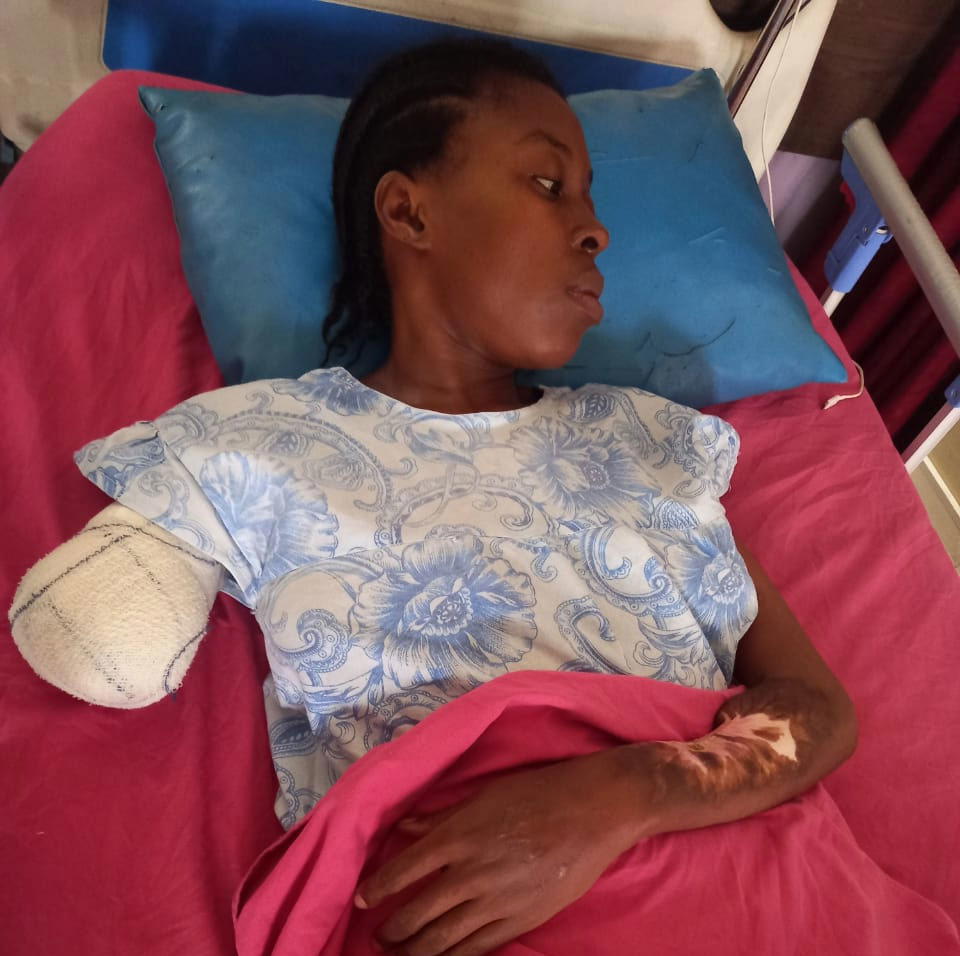 Sickle cell patient, Winnie Onuoha, seeks help with bills, prosthetic