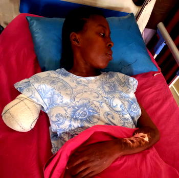 Sickle cell patient, Winnie Onuoha, seeks help with bills, prosthetic