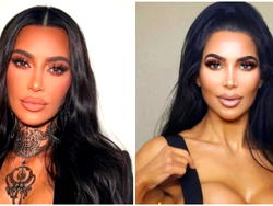 Kim Kardashian lookalike dies after plastic surgery