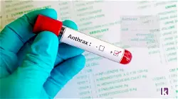 FG confirms first anthrax case in Niger 