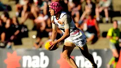 Female athlete diagnosed with CTE brain disease in first case