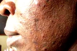 5 habits that could be damaging your skin