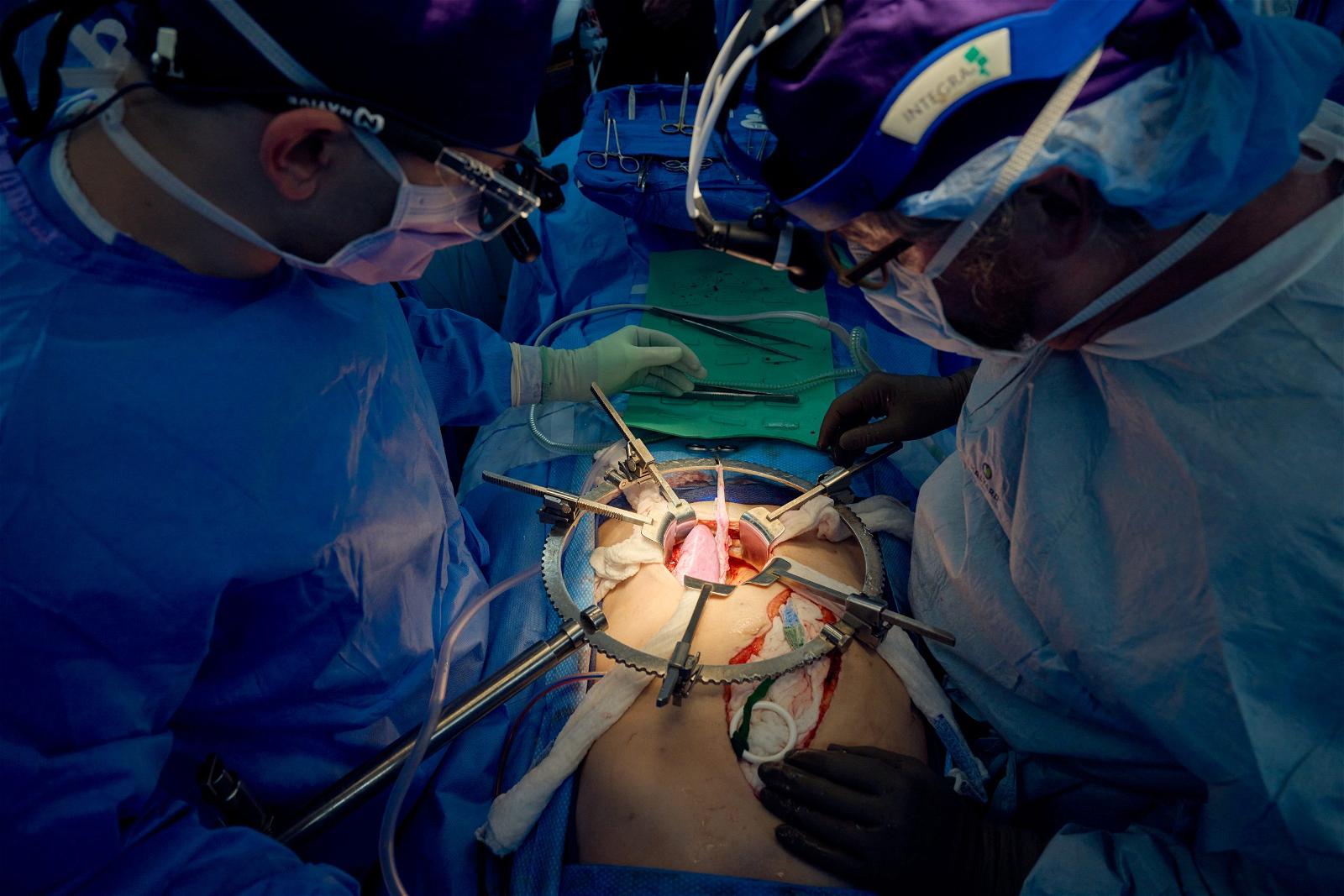 US surgeons report longest successful pigtohuman kidney transplant