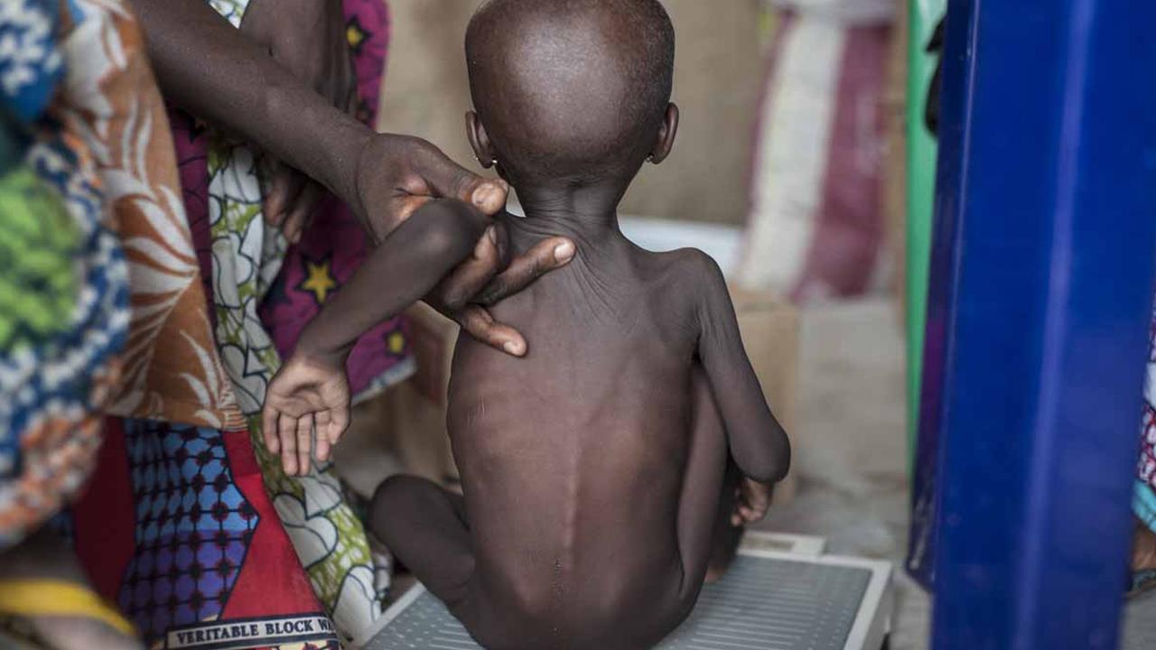 46% of Kano children have stunted growth, health official laments