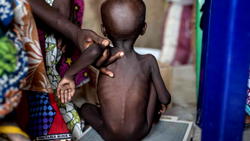 46% of Kano children have stunted growth, health official laments