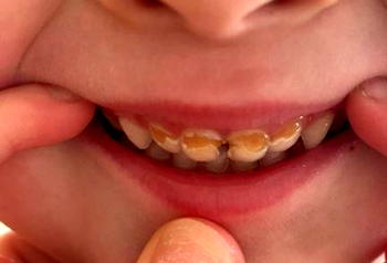 Over 120m Nigerians have poor dentition – Orthodontists