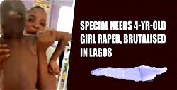 Special needs 4-yrs-old girl raped, brutalised in Lagos