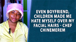 Even boyfriend, children made me hate myself over my facial hairs- Chef Chinemerem