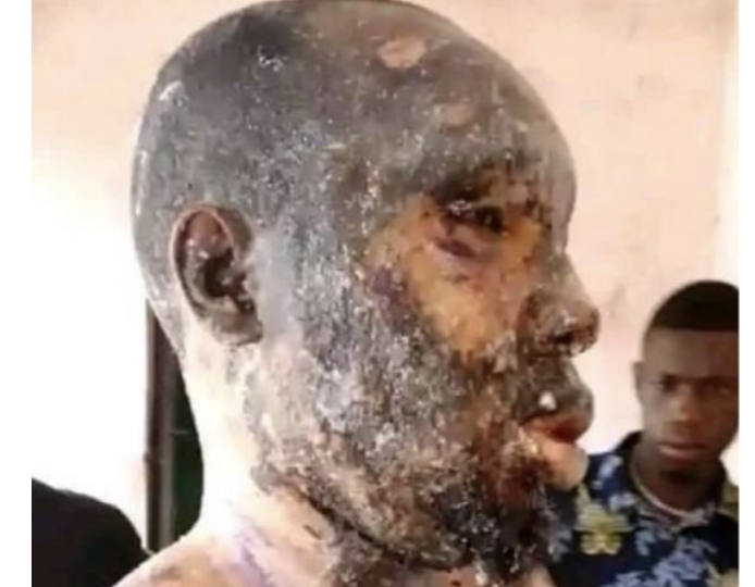Rivers’ woman bathes husband with hot oil