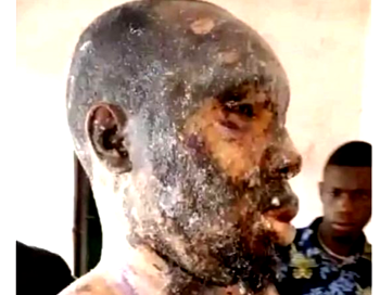 Rivers’ woman bathes husband with hot oil