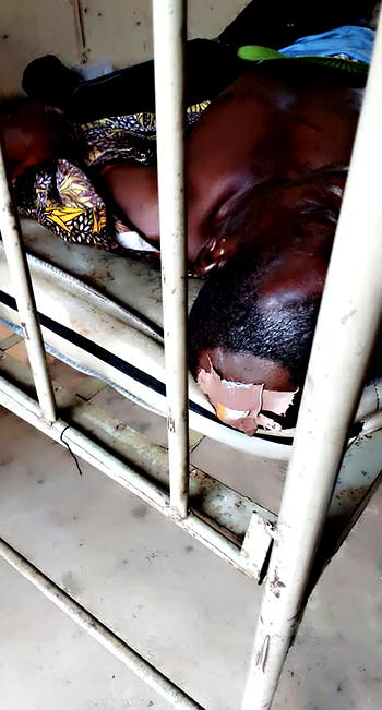 Sit-at-home: Victim’s family solicits help from Gov Nwifuru, others as Oko’s condition worsens