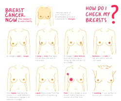Breast cancer, leading cause of death among women in Nigeria – BRECAN
