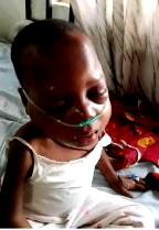 4-year-old leukaemia patient seeks N5m for chemotherapy