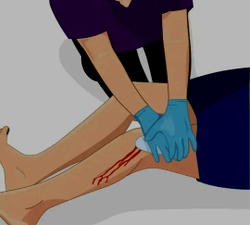 How to help someone who’s been stabbed