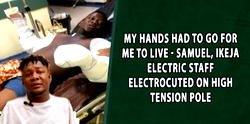 My hands had to go for me to live- Samuel, Ikeja Electric staff electrocuted on High Tension Pole