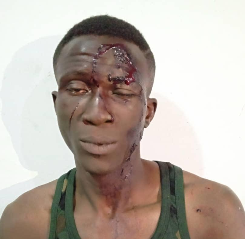 Police nab notorious armed robber for stabbing victim over iPhone in Abuja