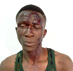 Police nab notorious armed robber for stabbing victim over iPhone in Abuja