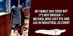 My family has tried but it’s not enough — Michael, who lost eye and leg in industrial accident