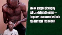 People stopped picking my calls, so I started begging -‘Engineer’ Lukman who lost both hands in freak fire incident