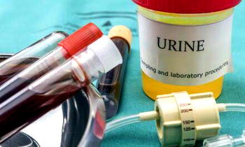 Breakthrough urine test could help men avoid unnecessary prostate biopsies