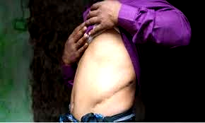 How organ harvesters deceived villagers to sell their kidneys