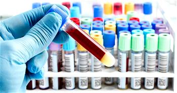 New blood test may detect 19 cancers 7 years before symptoms show