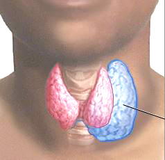 Silent crisis: 6m Nigerians have thyroid disease, say experts