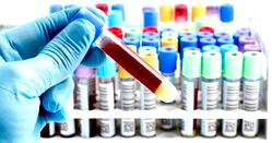 Single blood test may predict over 60 diseases