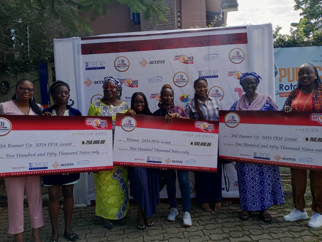 How I lost my job –  Sickle cell warrior