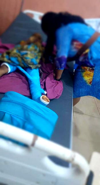 Police arrest woman who broke stepson’s bone with pestle