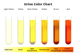 Urine colours and what each says about your health