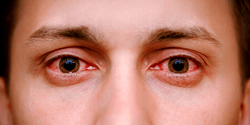 Why addicted mobile device users may suffer deplorable eye health