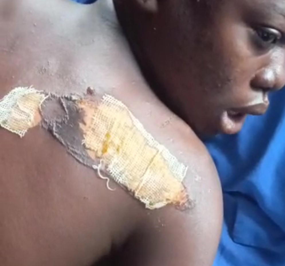 My father, stepmother attacked me with hot knife – 14-yr-old girl reveals